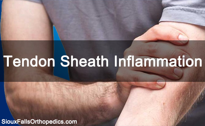 Introduction-to-Tendon-Sheath-Inflammation
