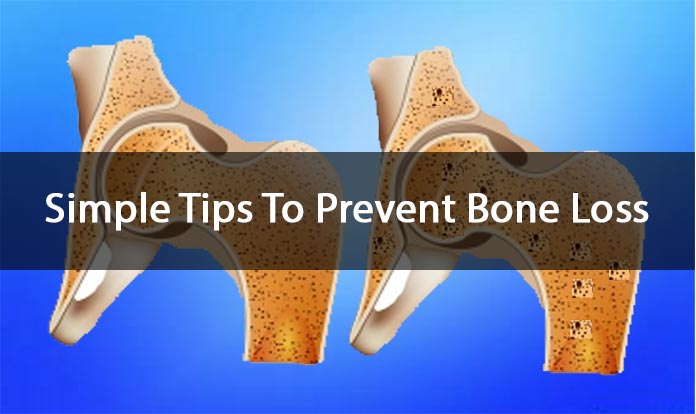 Simple Tips To Prevent Bone Loss