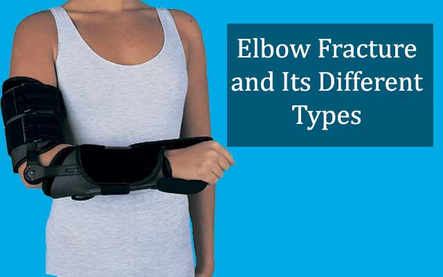 elbow fracture